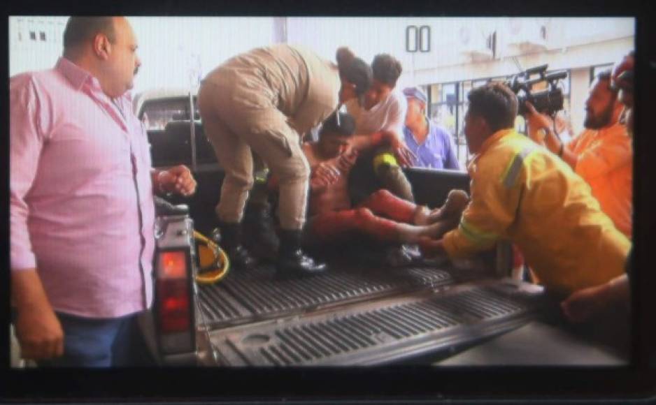 Según el vocero del Hospital Escuela Universitario, Miguel Osorio, los tres bomberos que permanecen en el quirófano del IHSS serán remitidos a este centro asistencial en las próximas horas, ya que no se cuenta con el equipo adecuado para su atención.