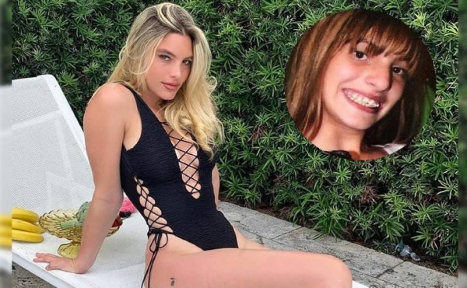 El cirujano plástico Dr. Kassir publicó varias fotos del antes y después de Lele Pons en el marco del 24 cumpleaños de la famosa venezolana.