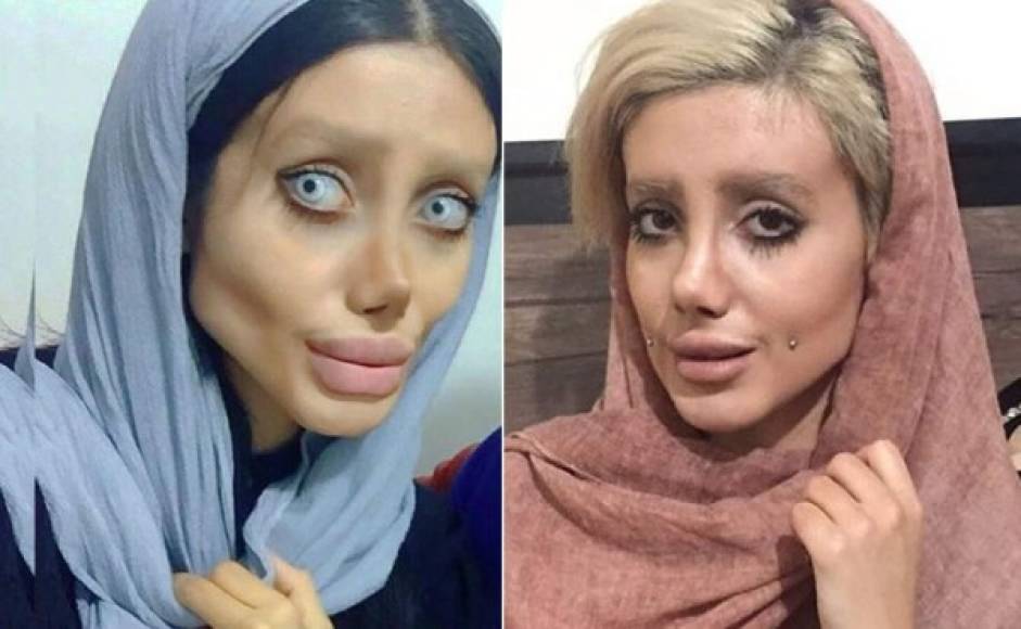 La semana pasada una joven iraní se volvió viral en las redes por su inusual aspecto, muchos la señalaron como una versión tenebrosa de la actriz Angelina Jolie.<br/><br/>Ahora la chica dio la razón de su tétrico look.