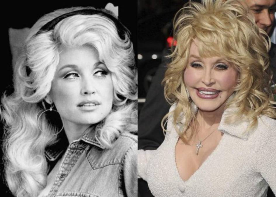 La reconocida cantante de música Country ha dicho que: “Nunca he pensado en mí misma como un sex symbol y no quiero tener que ser una mujer bella como Raquel Welch”. Sobre sus operaciones de cirugía estética, Dolly Parton asegura que nunca se ha puesto implantes mamarios (aunque sí que se ha operado para elevar sus pechos), y admite haberse hecho liposucciones así como inyecciones de colágeno.<br/><br/><br/><br/><br/>