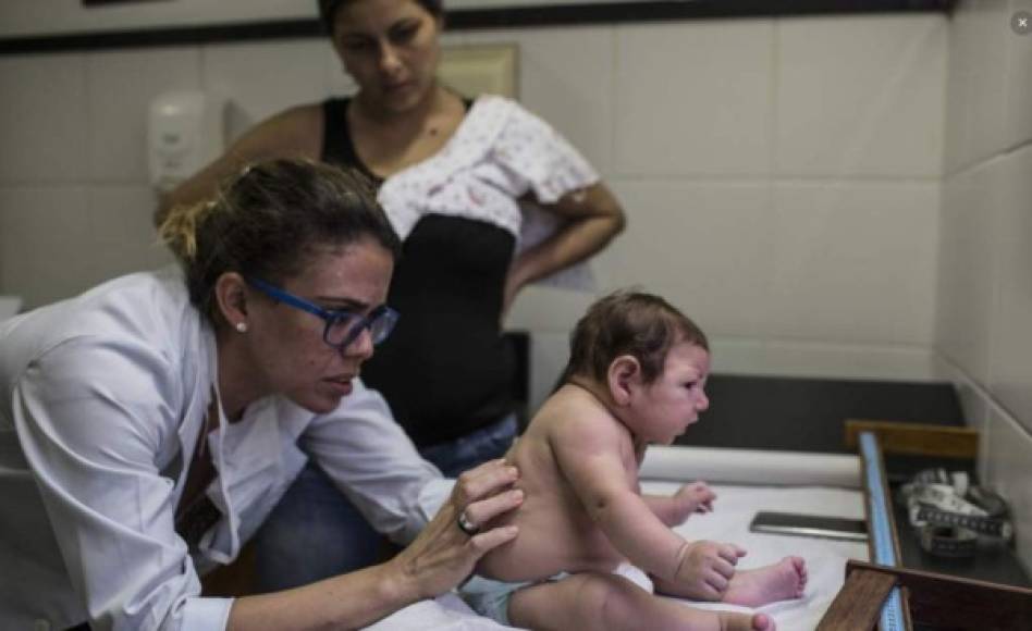 El virus del Zika causa microcefalia en algunos bebés de mujeres infectadas durante el embarazo al desviar una proteína clave en la división celular neural del feto en desarrollo, según un nuevo estudio publicado hoy en la revista Cell Reports. Un equipo de investigadores de la Universidad de Yale (Connecticut, EUA) concluye así que el zika mata a las células madre en el cerebro y afecta al proceso de creación de células cerebrales. De este modo, consideran que el virus del zika podría ser susceptible a los fármacos antivirales que ya están en el mercado y podrían evitar el trastorno en el desarrollo del sistema nervioso. Los científicos de Yale probaron que el virus desvía una forma de la proteína TBK1 de su principal función de organizar la división celular de la mitocondria, donde contribuye a iniciar la respuesta inmune. Al faltar esa proteína en la división celular, las células mueren en lugar de formar nuevas células cerebrales, lo que resulta en microcefalia.