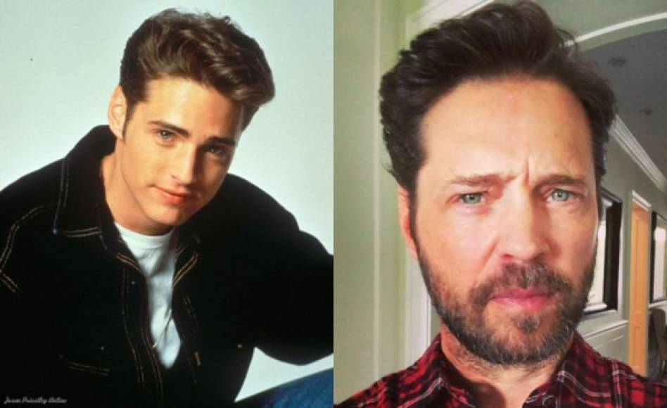 Jason Priestley<br/><br/>El famoso 'Brandon' en la serie juvenil estuvo a punto de morir en 2002, luego de terrible accidente de auto por conducir en estado de ebriedad, se ha ausentado de la televisión y tiene una vida normal. En 2015 se cayó de un caballo ahora tiene un historial de conmociones cerebrales. <br/><br/>Su caótica vida fue contada en el libro: 'Jason Priestley: A Memoir'