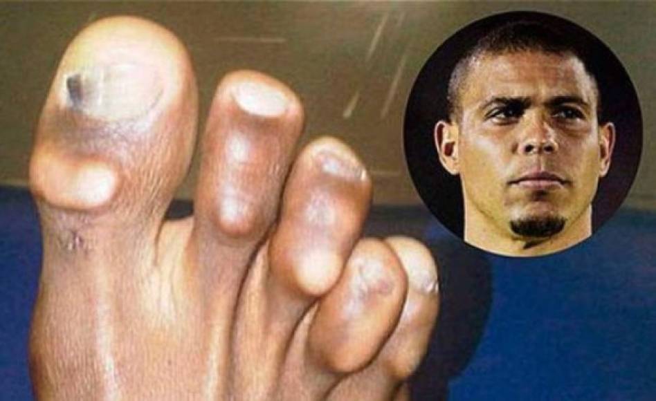 El astro Ronaldo Nazario, uno de los mejores delanteros centros de la historia y el mejor de los últimos 30 años no debería llevar esa imagen en los pies que poseen un talento infinito.