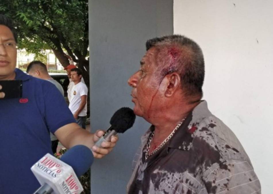 Varias personas de la tercera edad resultaron heridas durante los enfrentamientos en las protestas. Foto: Carlos Herrera.