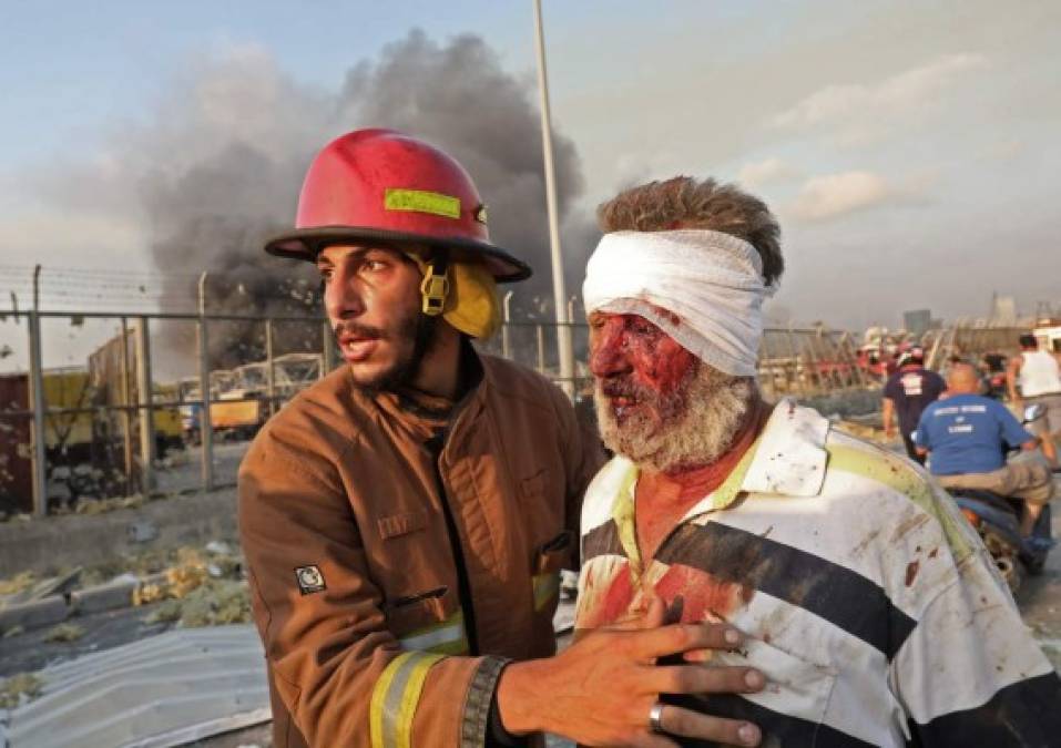 La agencia AFP divulgó imágenes de la devastación de la zona donde fueron las explosiones, cuerpos tirados y muchos heridos a kilómetros del epicentro.