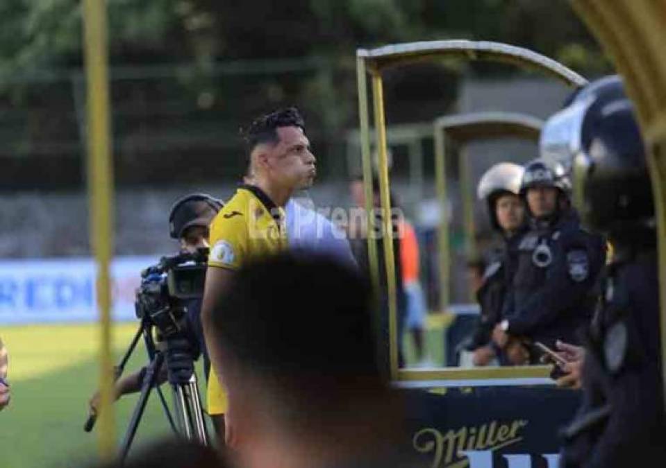 El delantero Ángel Tejeda perdió la cabeza luego de que escupió agua a un aficionado del Marathón que estaba en las graderías del estadio Yankel Rosenthal.