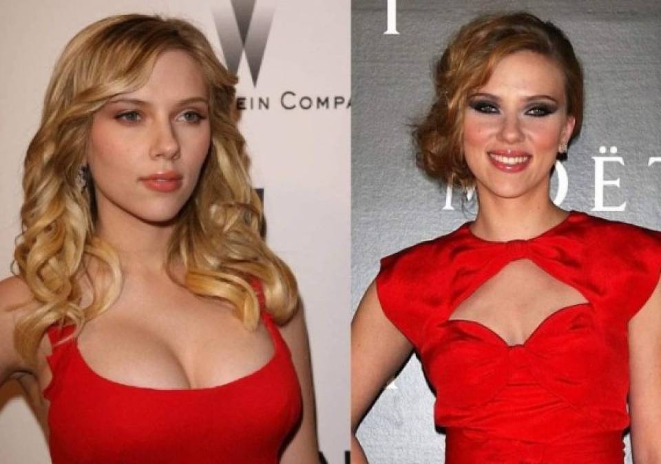 <a href='https://www.laprensa.hn/fotogalerias/1278518-411/scarlett-johansson-operacion-reduccion-senos-busto-cirugias-plasticas?page=1' style='color:red;text-decoration:underline' target='_blank'>Otra famosa que se ha practicado esta cirugía es Scarlett Johansson</a> , aunque ella nunca ha hablado de ello, los cambios en el tamaña de sus senos han sido evidentes con el paso del tiempo.