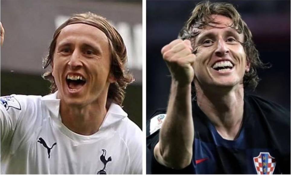 Luka Modric - El centrocampista croata del Real Madrid esperó mucho para someterse al tratamiento, pero ya en la capital de España se decidió a alinear su dentadura.