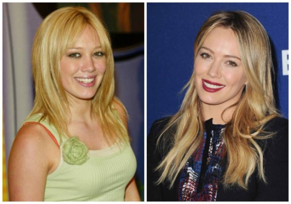 Hilary Duff también se hizo un tratamiento en su nariz.