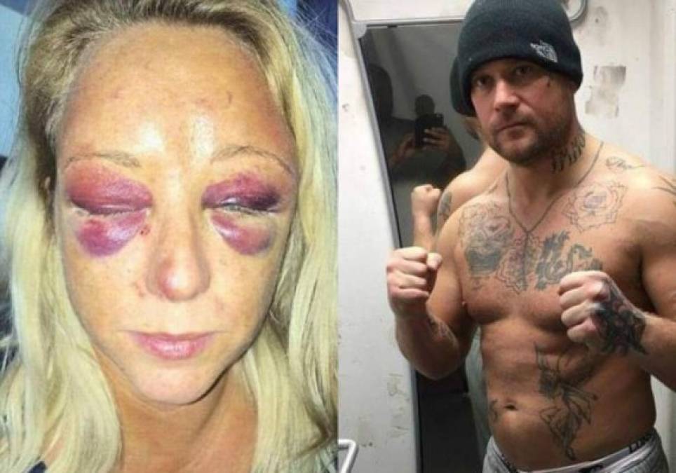 Un boxeador británico intentó convencer a la gente de que había sido víctima de violencia doméstica después de darle una brutal golpiza a su novia y enviarla al hospital con heridas horribles. Russell Mason, de 35 años, fue encarcelado por golpear a Sarah Wheatley hasta que estuvo inconsciente en un hotel en Birmingham mientras sus hijas, de dos y cinco años, estaban durmiendo en la habitación contigua.<br/>