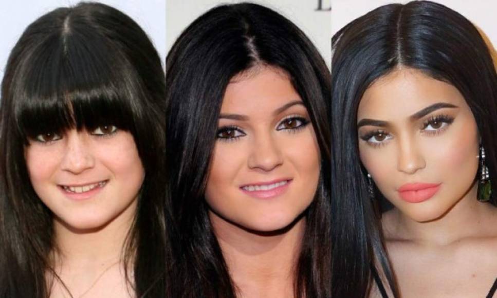 Kylie se sometió a varias cirugías para poder tener la figura y el rostro que actualmente tiene.