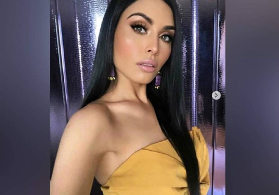 La reina de belleza Kristal Silva, de origen mexicano, estuvo al borde de la muerte en su intento por bajar de peso y tener figura perfecta.