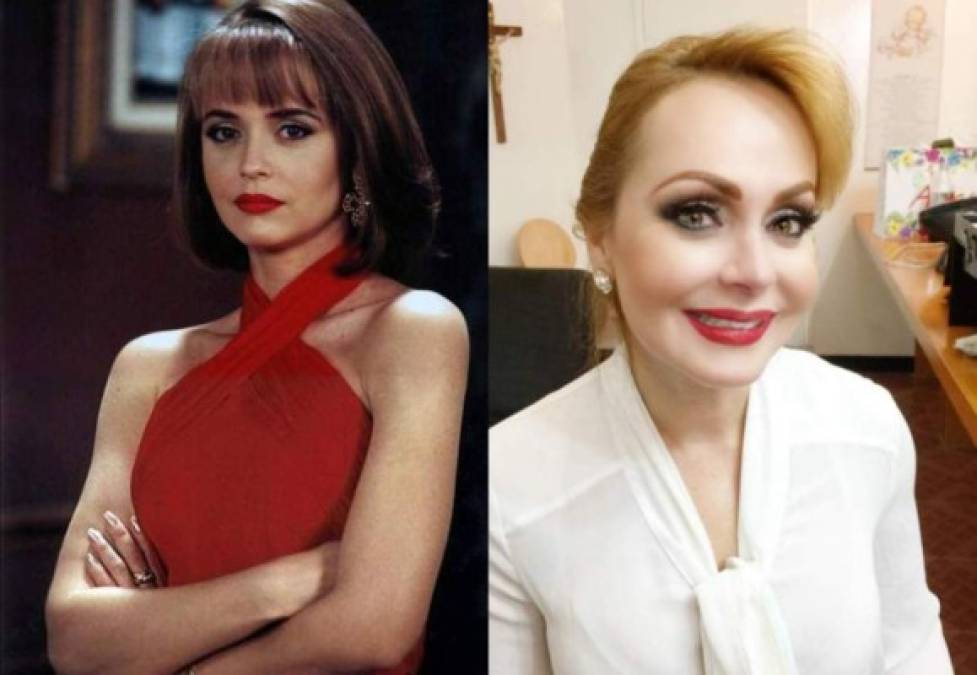 ¿Cómo luce mejor Gabriela Spanic, antes o después de las cirugías?