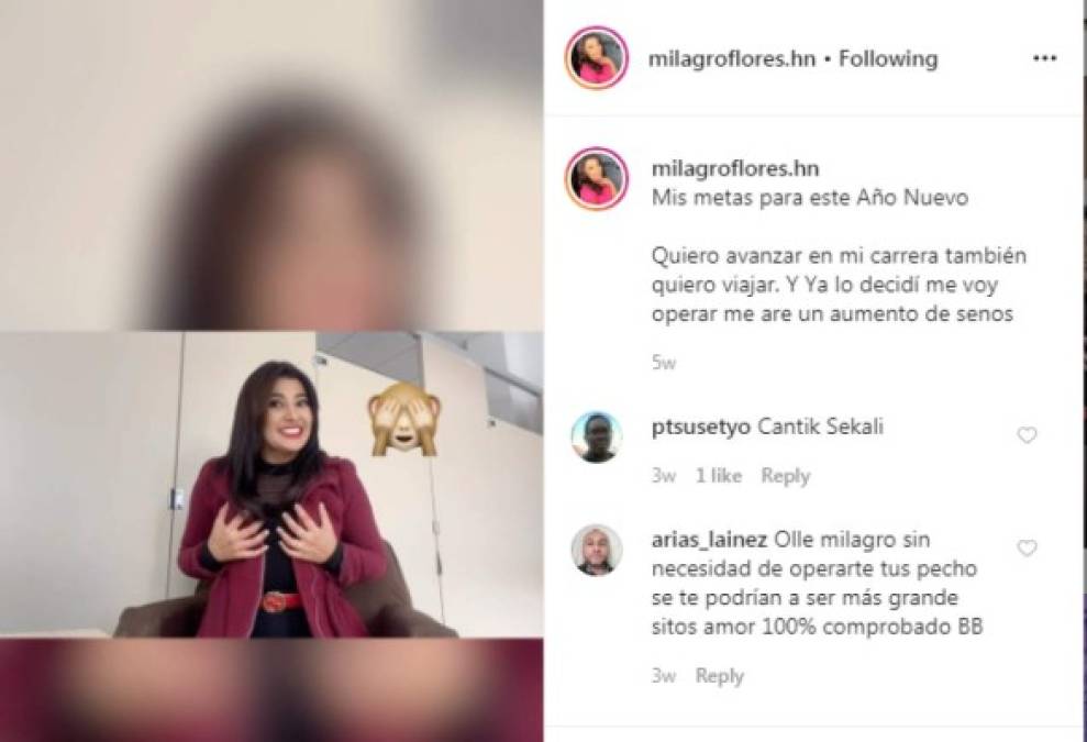 Milagro Flores es la primera presentadora hondureña en develar públicamente que se sometería a una cirugía plástica. En 2019, lo prometió como meta de 2020.