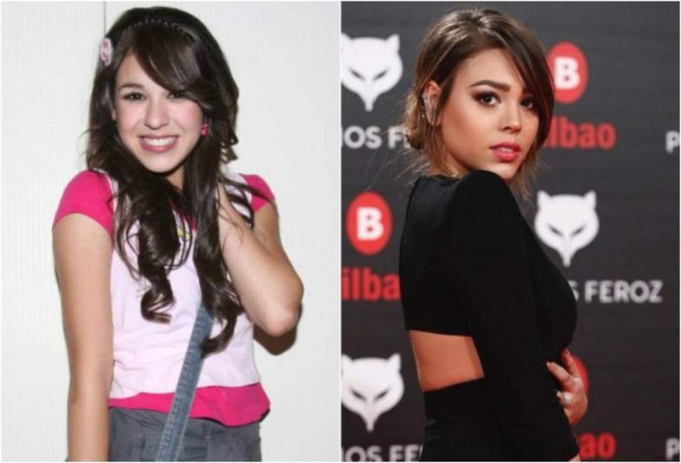 Danna Paola confesó años atrás que se sometió a una cirugía plástica de nariz. Según la mexicana fue por motivos de salud ya que su tabique nasal estaba muy mal y le impedía cantar, además de que no podía respirar bien.