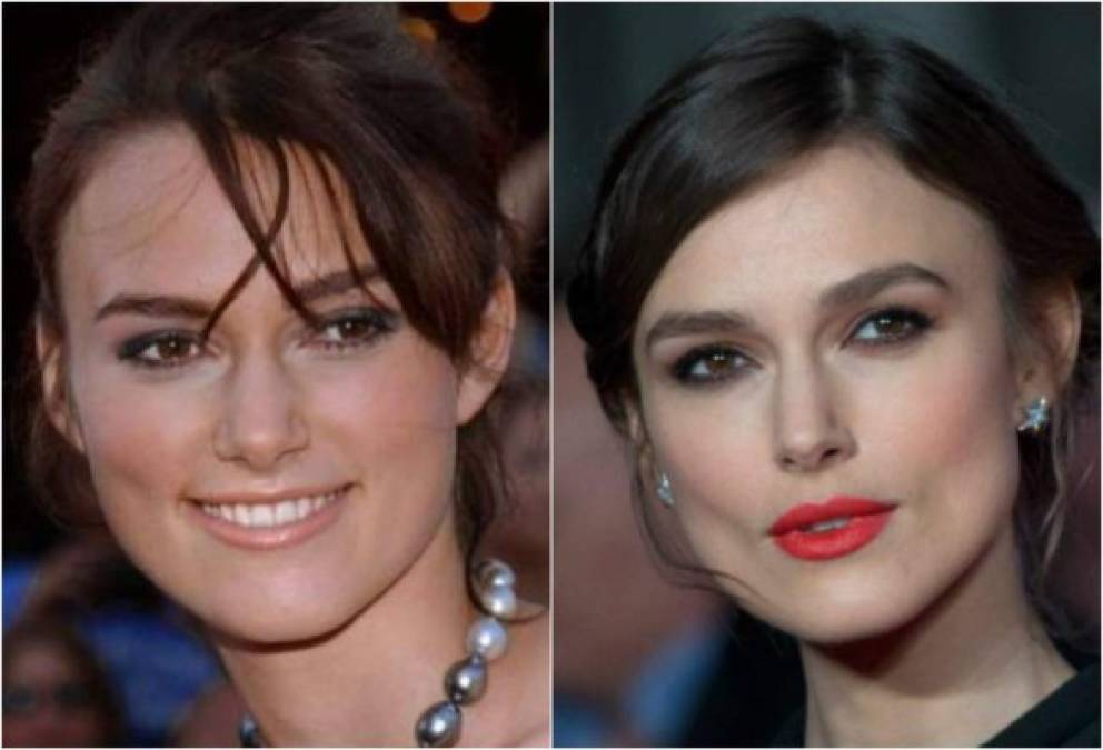 Keira Knightley es otra de las celebridades que pasó por el quirófano, pese a que ella nunca ha hablado del tema sus fotos la delatan.