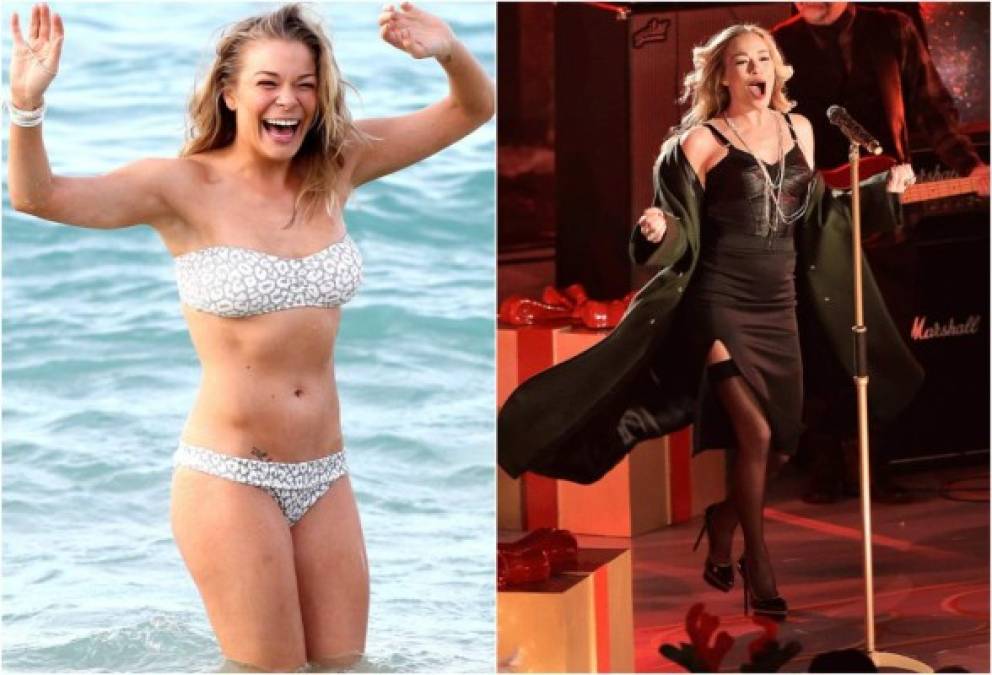 LeAnn Rimes, ganadora del Grammy, en dos ocasiones fue diagnosticada con psoriasis: cuando tenía sólo dos años de edad y cuado tenía seis, en ese momento ya le cubría el 80% de su cuerpo. <br/><br/>Fue estigmatizados como la 'chica escamosa' cuando era niña, y tenía miedo de usar vestidos cortos sobre la alfombra roja, incluso en la edad adulta.<br/><br/>'Ahora está claro, gracias a opciones de medicamentos y cuidado de estilo de vida, tales como la alimentación saludable, que hacer una sesión de revista en un bikini es 'uno de los mejores momentos de mi vida', dijo Rimes en una entrevista.<br/>