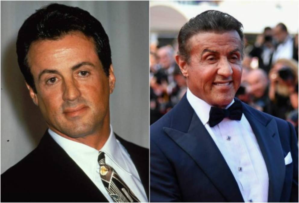 Sylvester Stallone ha tenido impactante cambio en su rostro con el paso del tiempo debido al abuso de cirugías y uso excesivo de bótox.