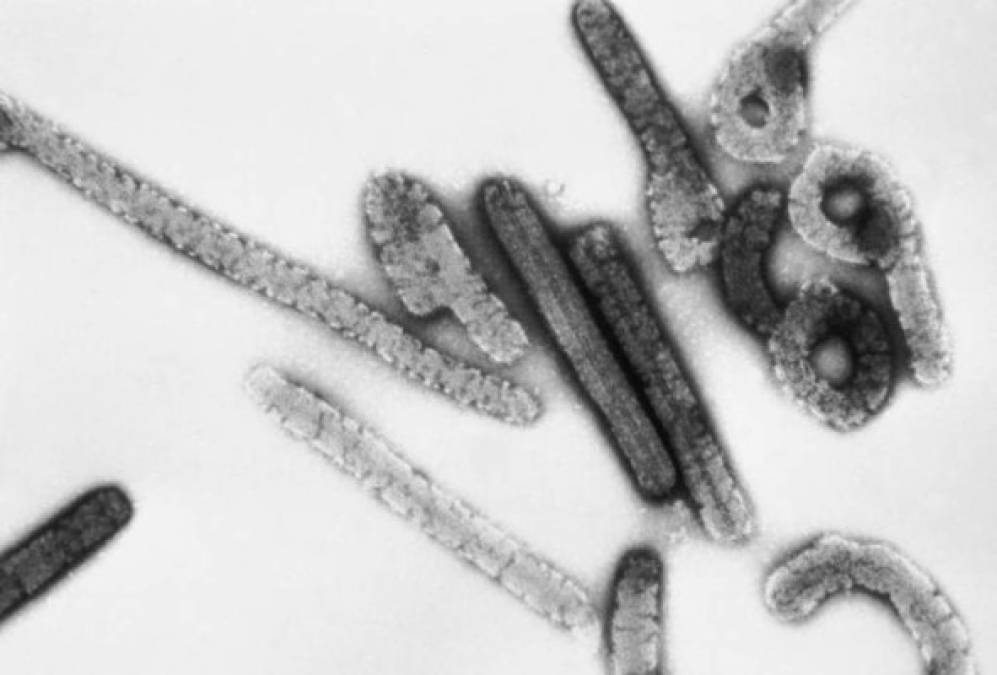 Marburgvirus - Fue identificado en 1967, cuando surgieron pequeños brotes entre los trabajadores de un laboratorio en Alemania que estuvieron expuestos a monos infectados importados de Uganda. El virus de Marburgo es similar al Ébola en que ambos pueden causar fiebre hemorrágica, lo que significa que las personas infectadas desarrollan fiebre alta y hemorragias en todo el cuerpo que pueden provocar shock, insuficiencia orgánica y muerte.