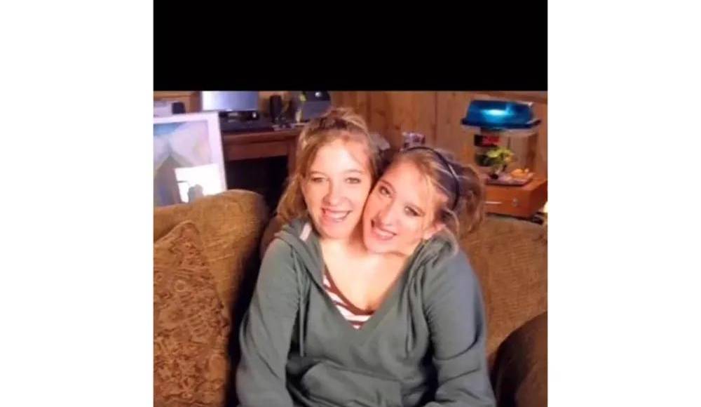 Nacidas en Minnesota, Abby y Brittany capturaron la atención del mundo desde su aparición en el programa de Oprah Winfrey en 1996.