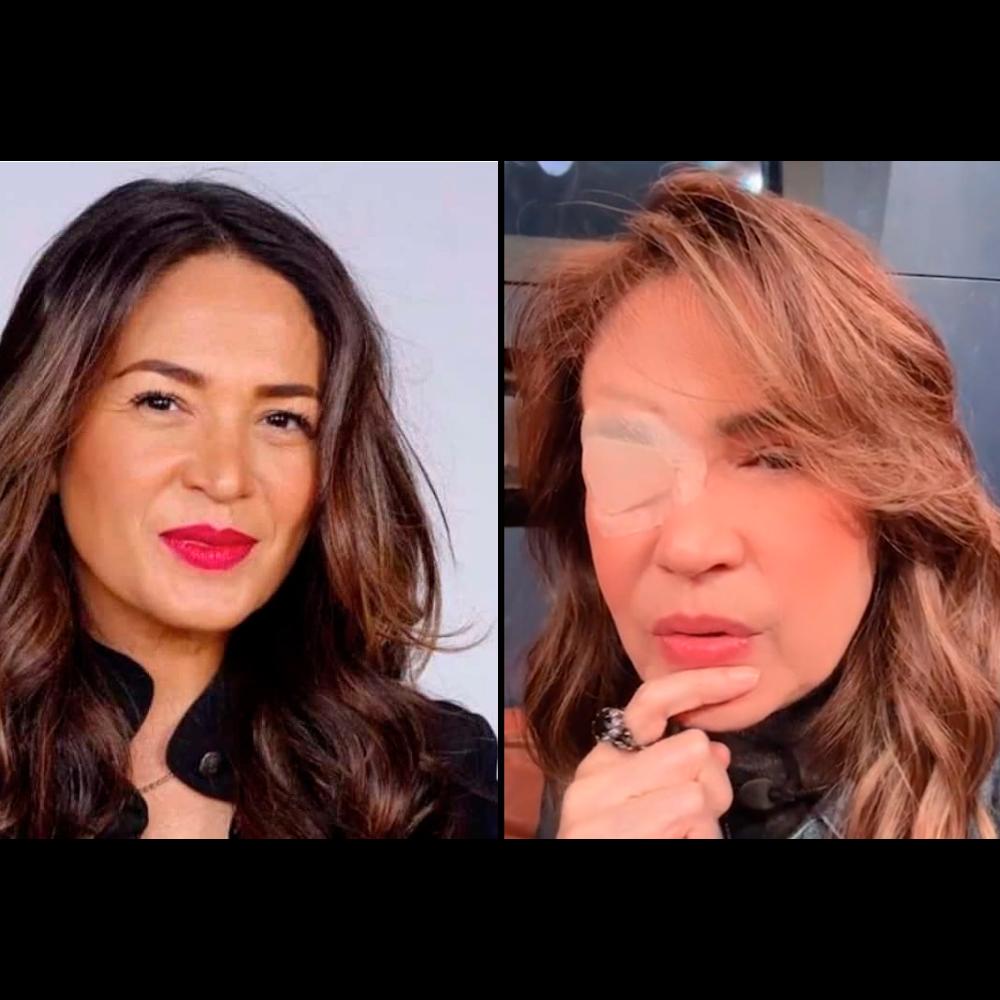 Cambio físico de Yolanda Andrade: así luce en la actualidad