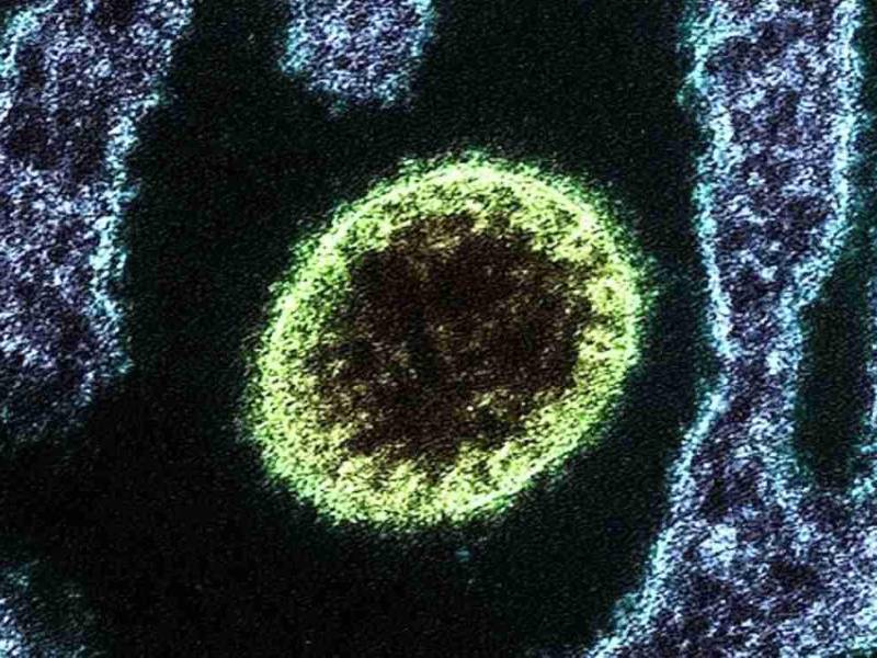 El resurgimiento del virus Nipah ha incendiado las alarmas a nivel mundial luego de que se reportaran miles de casos en India y que ha dejado como saldo dos personas fallecidas.