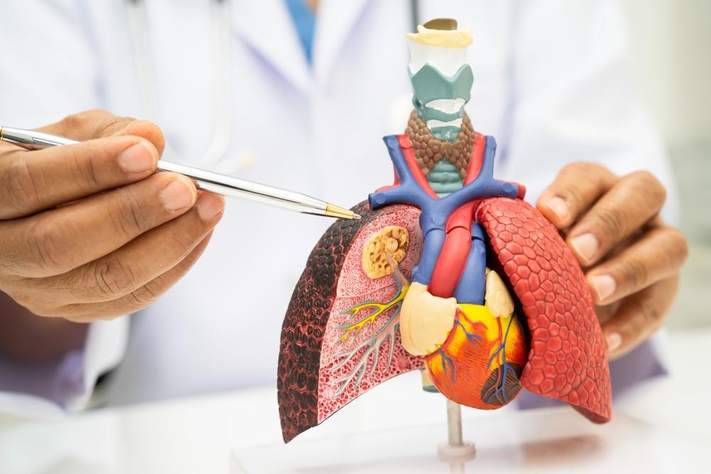 Cáncer de pulmón: detectar la enfermedad a tiempo puede salvar vidas