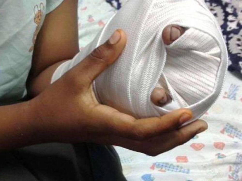 Hospital Mario Rivas reporta primer herido por pólvora