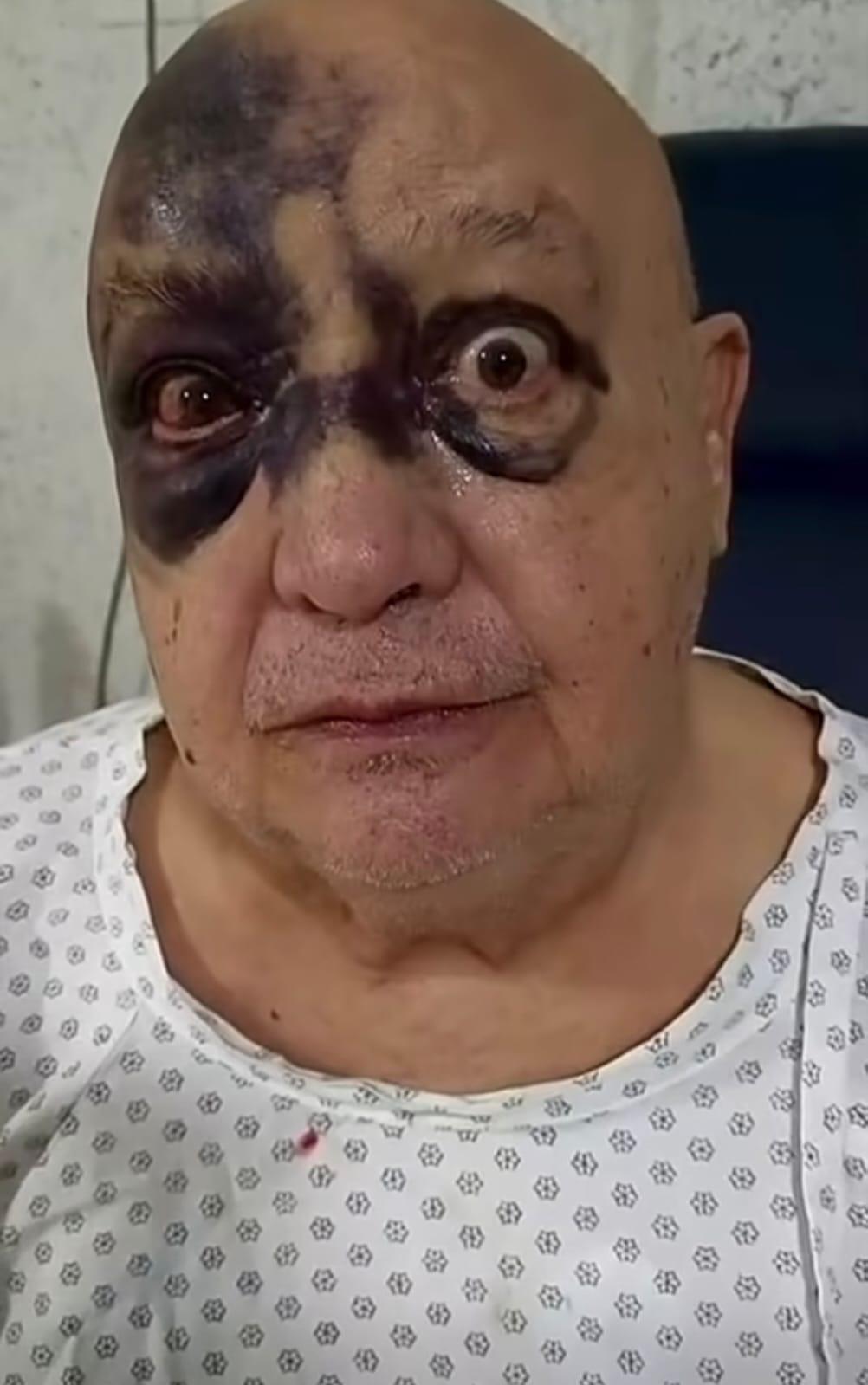 ¿Cómo está Luis de Alba, el Pirruris, tras accidente que lo llevó al hospital?