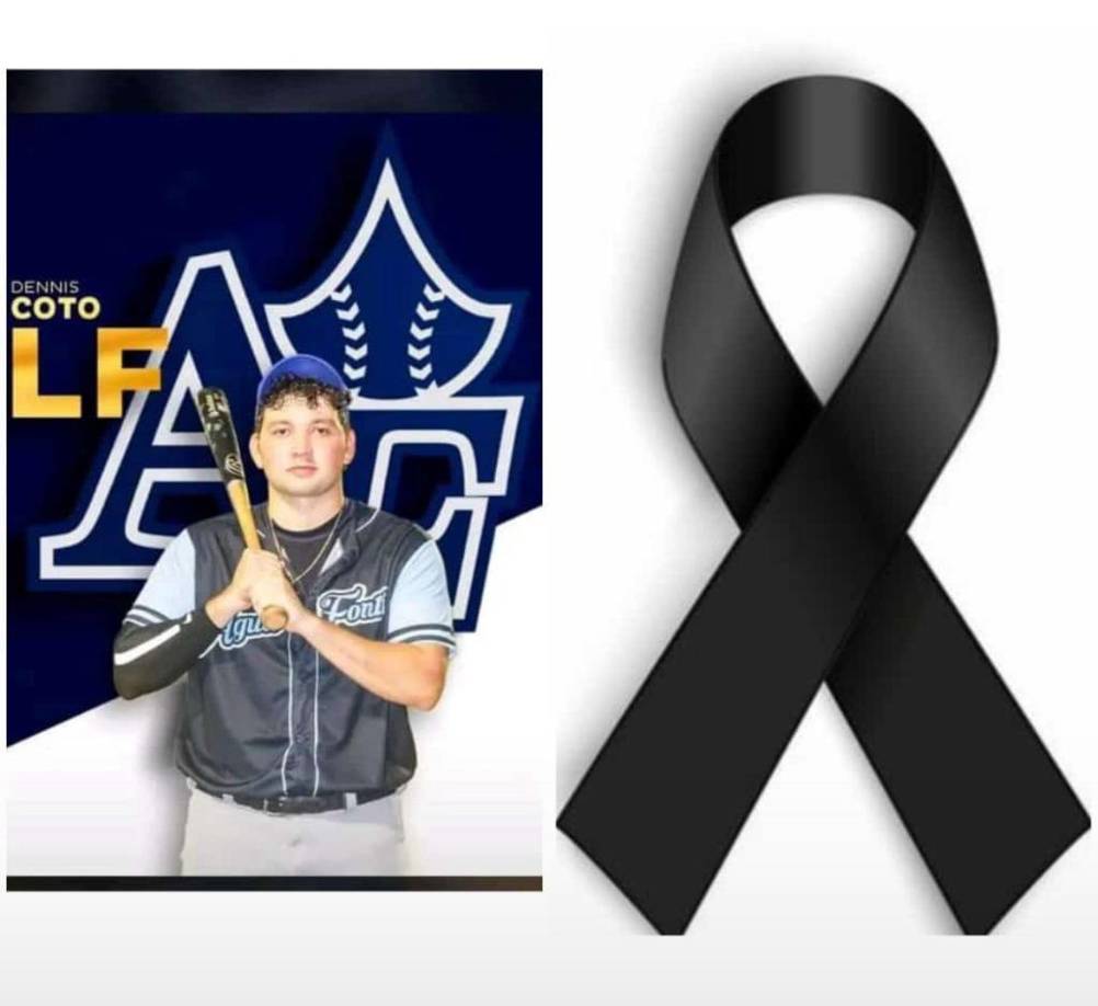 “Que Dios te tenga en su santa gloria mi rey. Qué feo es tener que escuchar esta horrible noticia; buen hombre, buen hermano, buen hijo, buen amigo , entre tantas cosas que te distinguían. Te mando un abrazo hasta el cielo bro te recordaré siempre”, lo describió uno de sus mejores amigos.