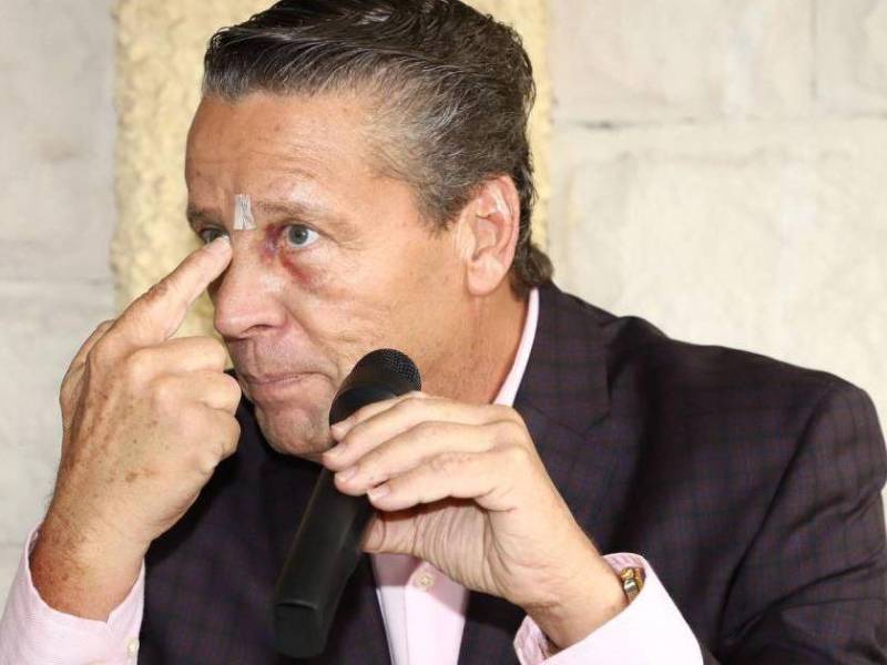 La actriz Diana Golden ganó una demanda contra el también actor Alfrdo Adame por difamación. La estrella de telenovelas aseguró que diversas declaraciones de Adame afectaron su salud mental.