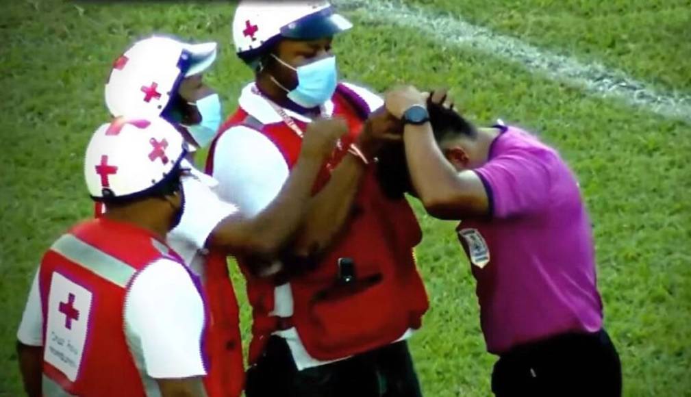 El árbitro asistente Gerson Mencías fue agredido en el duelo Olancho FC-Marathón, le lanzaron un objeto desde las gradas del estadio Juan Ramón Brevé Vargas e impactó en su cabeza.