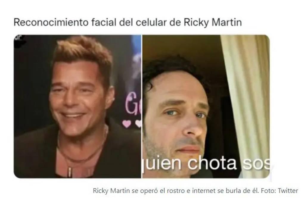 Lluvia de memes por radical cambio facial de Ricky Martin