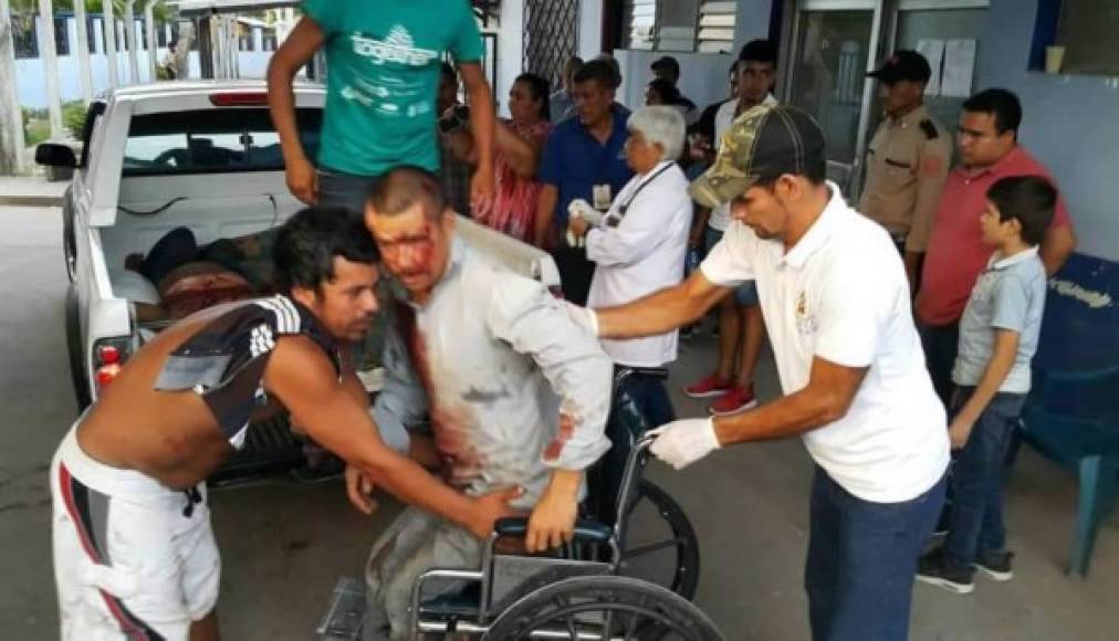 El accidente ocurrió ayer por la tarde en el municipio de Concepción Sur de Santa Bárbara.