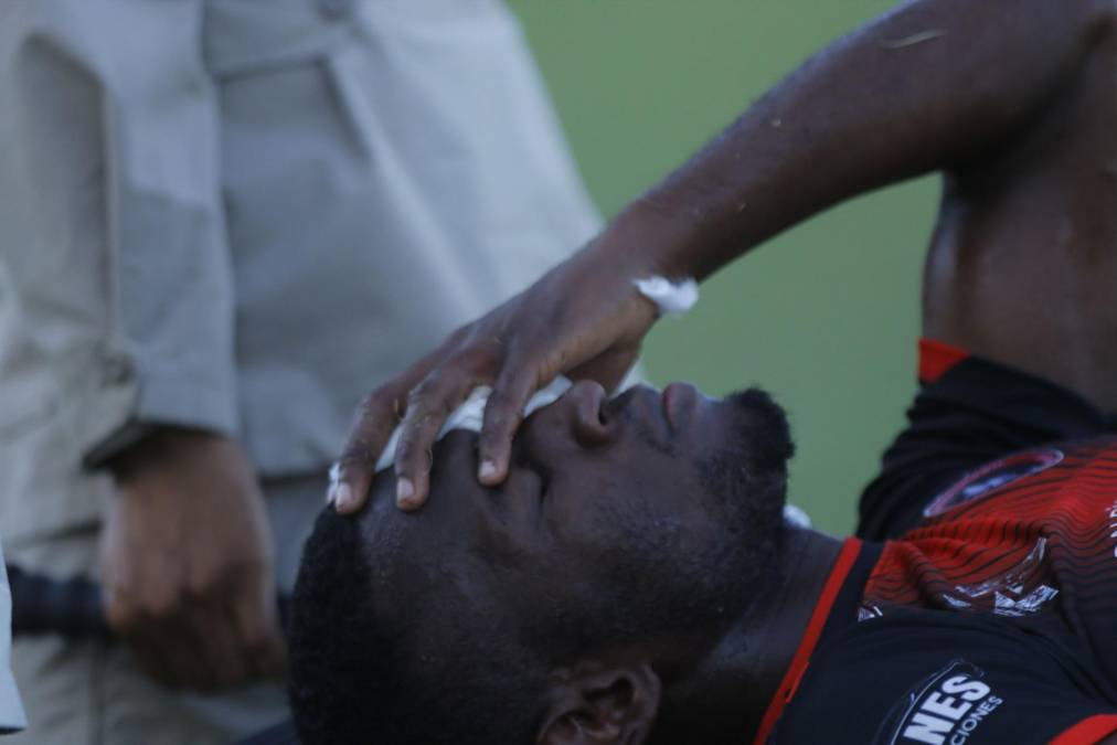 Imágenes fuertes: Las heridas de los jugadores del Independiente