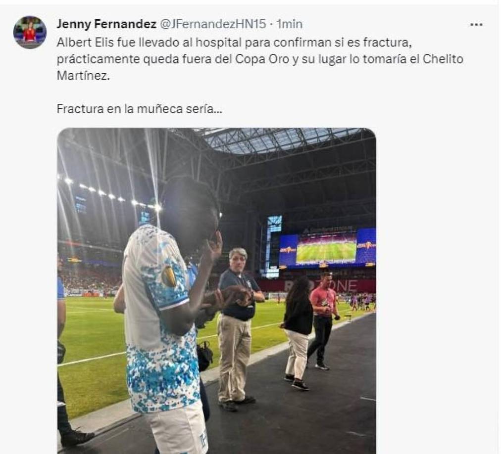 Jenny Fernández, presentadora de DIEZ TV, informó sobre la lesión de Alberth Elis.