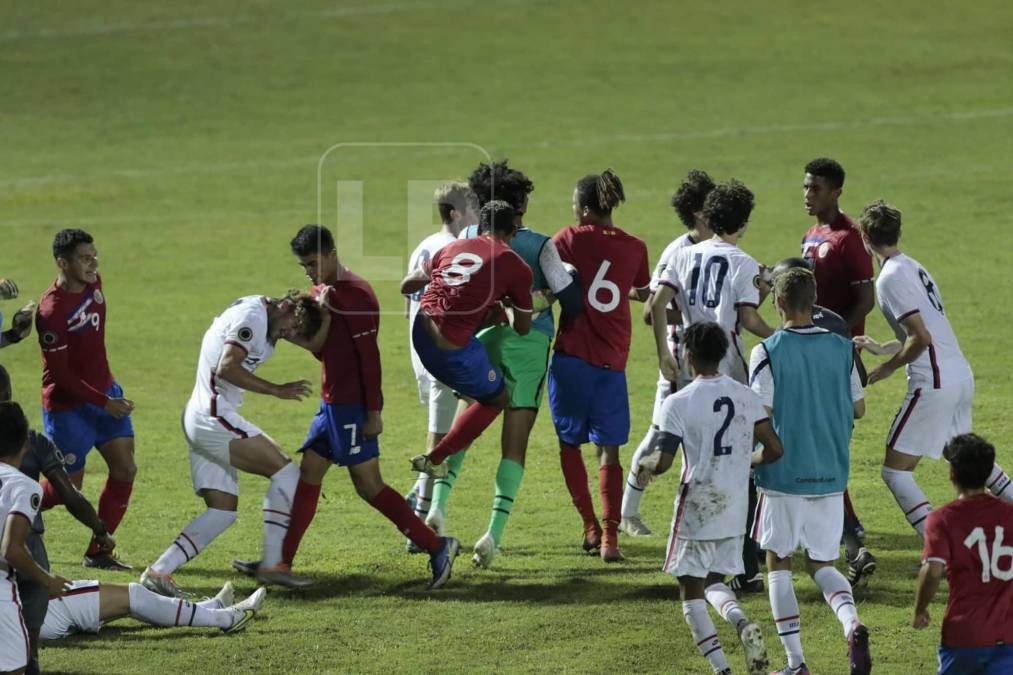 Los futbolistas costarricenses se desataron tras el final del juego. El primer jugador (identificado) que comenzó la pelea fue Timothy Arias Sinclair, quien llegó a agredir a Quinn Sullivan.