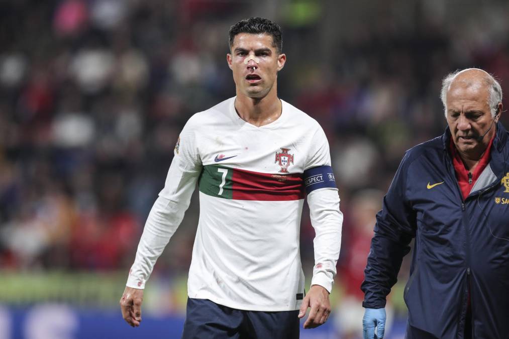 Fotos: El susto de Cristiano Ronaldo tras impactante golpe recibido en el rostro