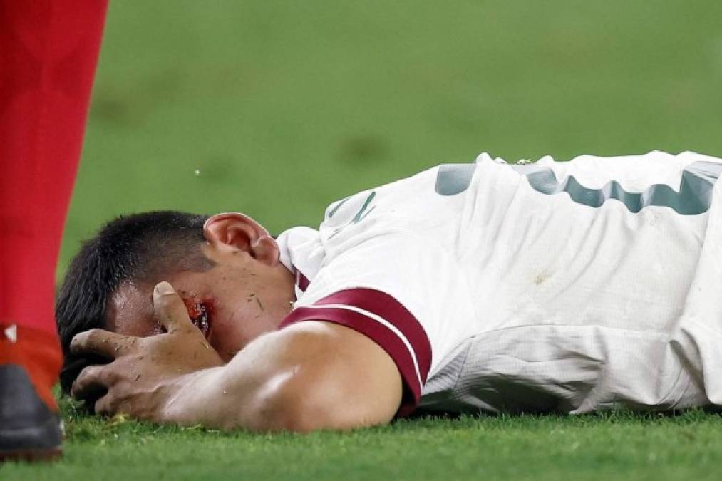 El delantero mexicano del Napoli quedó inconsciente tras el brutal golpe.