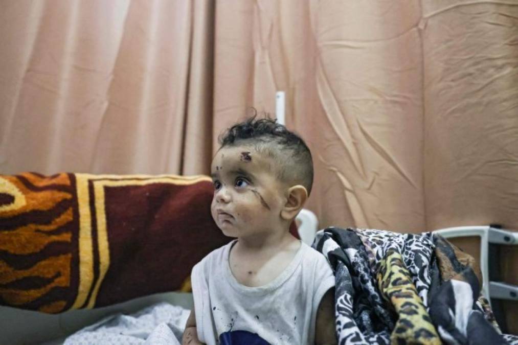 Los hospitales de Gaza evacúan a los heridos por temor a ser alcanzados por los bombardeos.