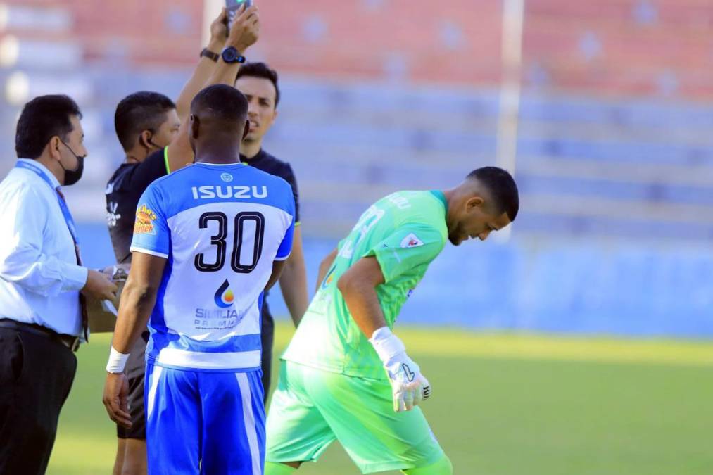 Héctor Vargas no se anduvo con rodeos para el inicio del segundo tiempo y sacó al portero Roberto López para darle entrada a Esau Flores. El entrenador argentino se mostró molesto con el ‘Pipo’.