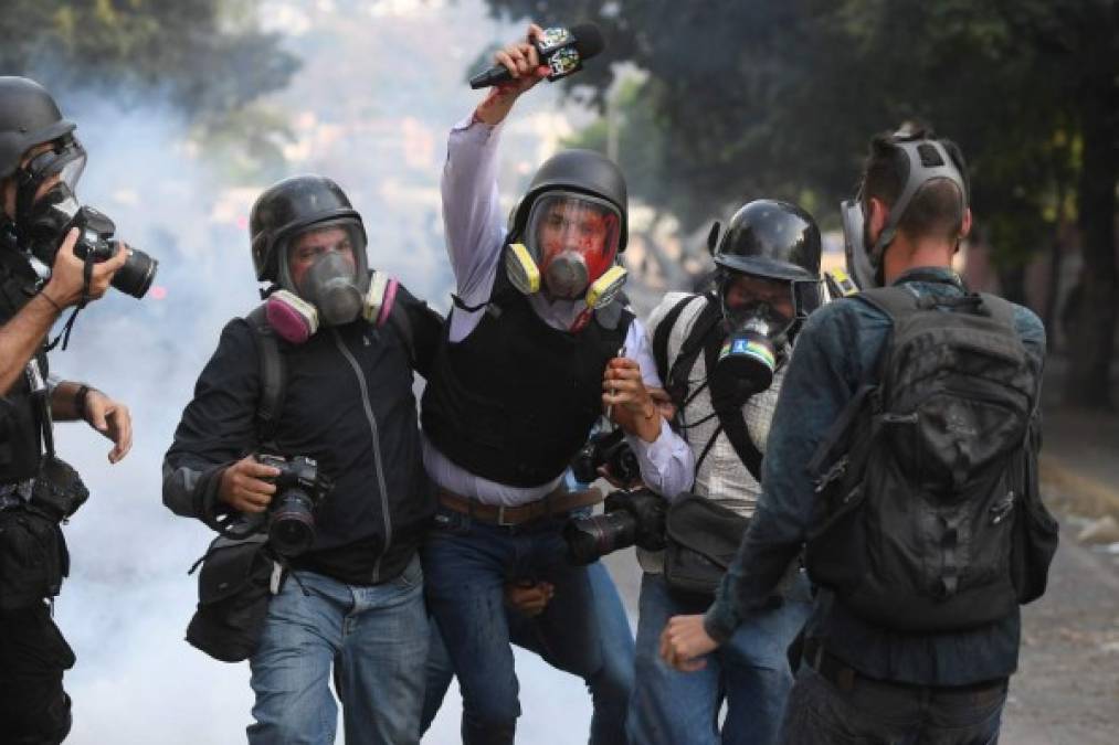 Venezuelan VPITV journalist Gregory Jaimes (C) is assisted by colleagues after being injured during clashes of anti-government protesters and security forces during the commemoration of May Day on May 1, 2019 after a day of violent clashes on the streets of the capital spurred by Venezuela's opposition leader Juan Guaido's call on the military to rise up against President Nicolas Maduro. - Guaido called for a massive May Day protest to increase the pressure on Venezuelan President Nicolas Maduro. (Photo by Federico Parra / AFP)