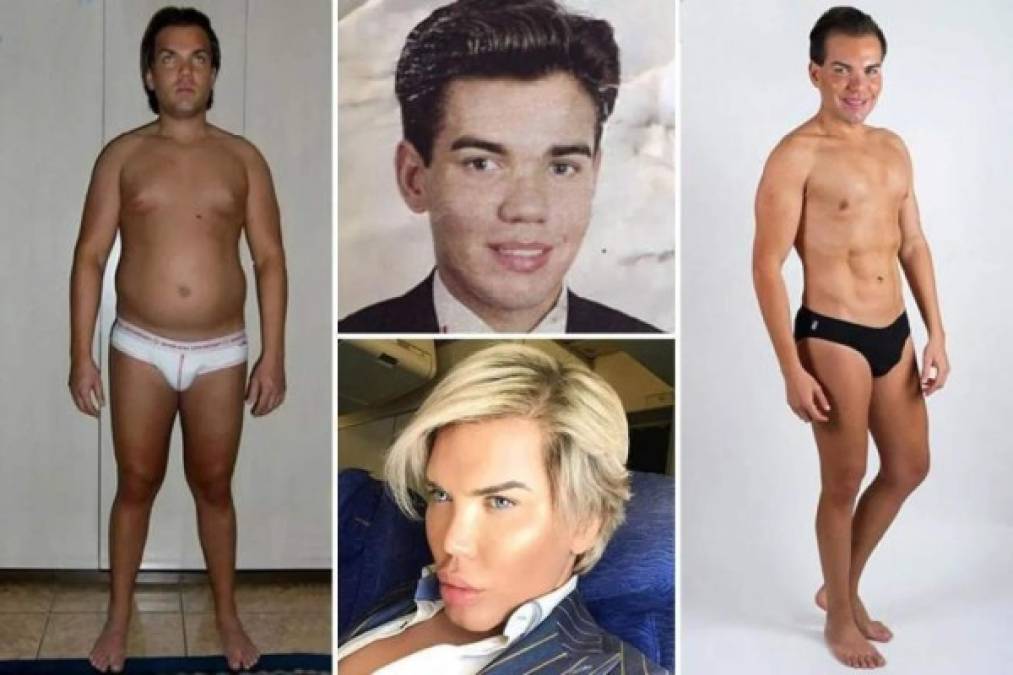 Rodrigo Alves prometió que revelaría luego el nombre que usará ahora que ha decidido ser mujer. MIRA: <a href='https://www.laprensa.hn/fotogalerias/farandula/1338786-411/alejandra-guzman-cirug%C3%ADas-que-deformaron-su-rostro' style='color:red;text-decoration:underline' target='_blank'> Las cirugías que han desfigurado a Alejandra Guzmán</a>