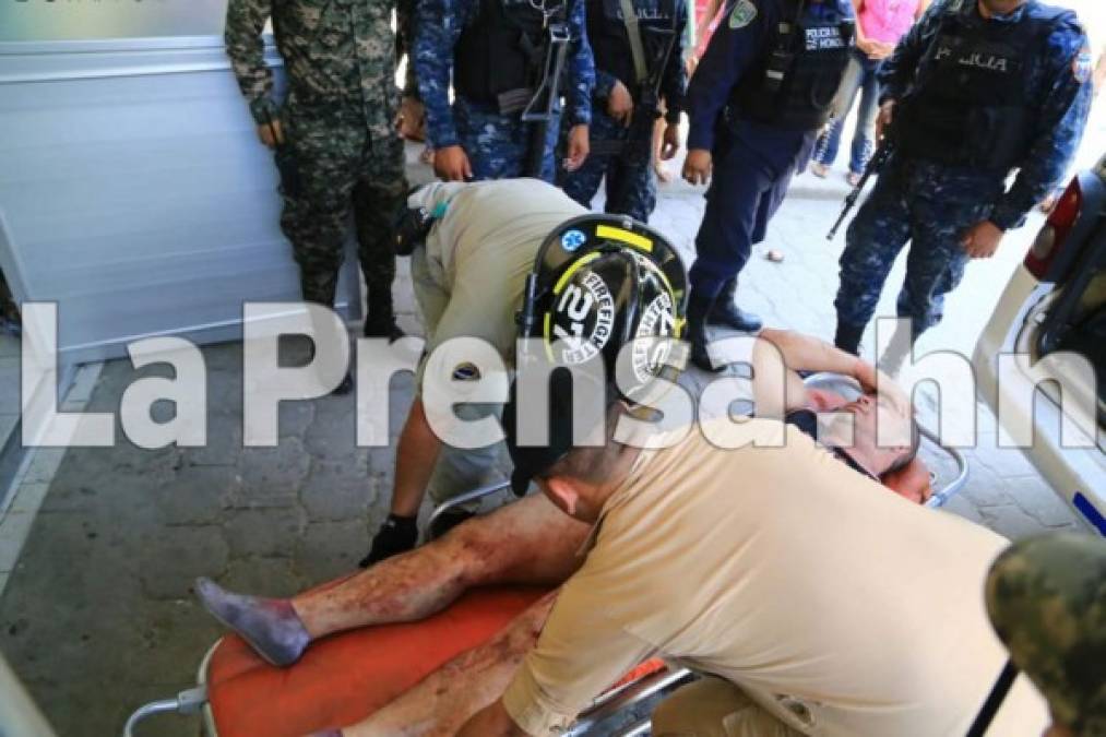 Varios de los reclusos heridos fueron trasladados al hospital Mario Rivas de San Pedro Sula.