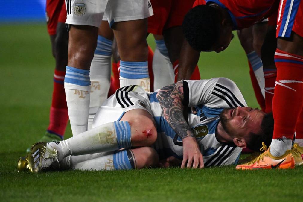 Messi sangró de su rodilla derecha después de la fea entrada que sufrió