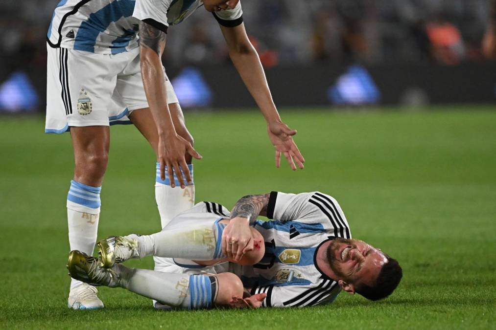 El dolor de Messi, ensangrentado de su rodilla derecha.