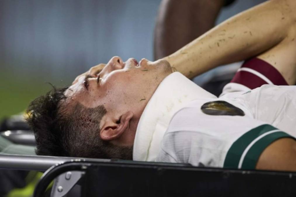 Al 'Chucky' Lozano le pusieron un collarín, mientras el mismo futbolista se sostenía un trapo que le cubrió la herida que tenía en la ceja izquierda.