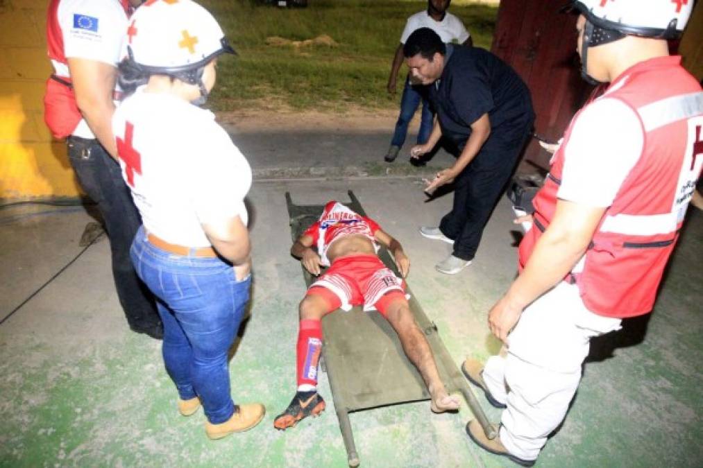Carlos Arrieta, jugador del Vida, dejó el partido en camilla tras un golpe en su pierna izquierda.