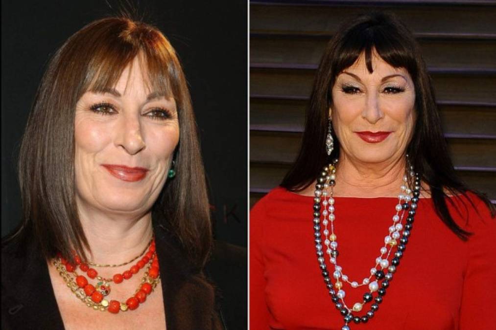 Varios criticaron la cirugía de Anjelica Huston en su rostro. ¿Qué opinas?<br/>