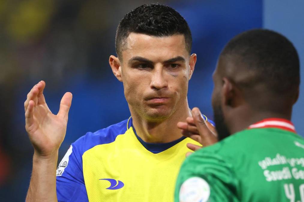 Cristiano Ronaldo, con el ojo morado, saludando a los jugadores del Al-Ettifaq.